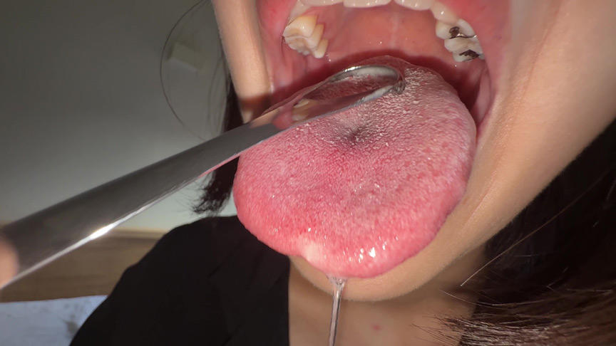 「【湊波流】舌ブラシで舌苔採取する個人撮影フェチ動画|唾液・口腔マニア必見」のサンプル画像12枚目