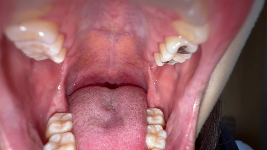 「【湊波流】舌ブラシで舌苔採取する個人撮影フェチ動画|唾液・口腔マニア必見」のサンプル画像7枚目