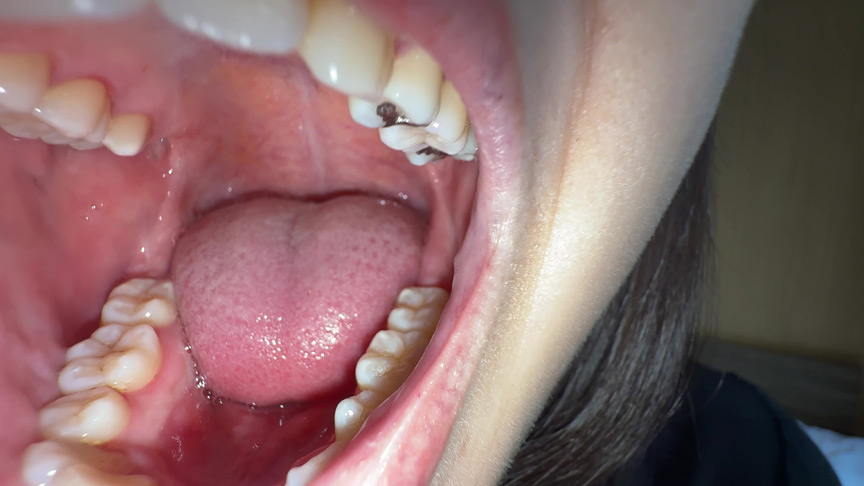 「【湊波流】舌ブラシで舌苔採取する個人撮影フェチ動画|唾液・口腔マニア必見」のサンプル画像9枚目
