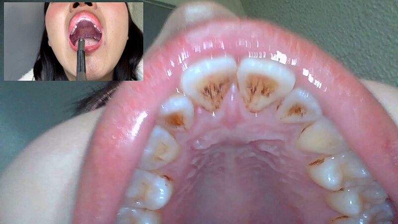 「【素人ナンパ】コールセンター勤務の美人お姉さんに街角で声かけ!口内観察に恥じらう姿が可愛すぎる」のサンプル画像13枚目