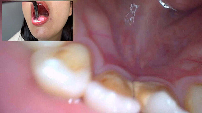 「【素人ナンパ】コールセンター勤務の美人お姉さんに街角で声かけ!口内観察に恥じらう姿が可愛すぎる」のサンプル画像14枚目