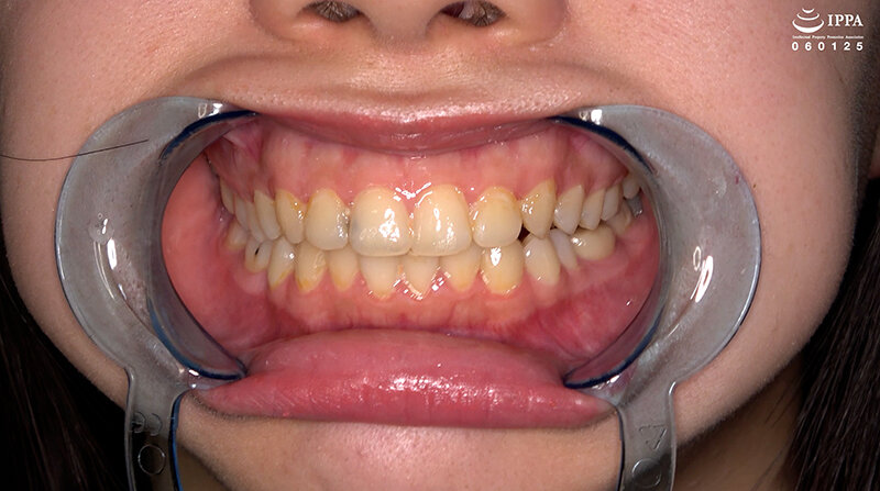 「【甘井くるみ】口内観察・歯・のどちんこ接写＆咀嚼プレイ【フェチ動画】貴重映像で魅せる巨大女の世界」のサンプル画像4枚目