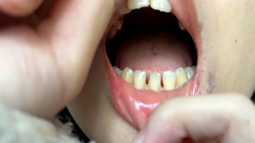 「【あむちゃん】素人コールセンター美女の口内観察プレイ【フェチ動画】街角ナンパ企画」のサムネイル