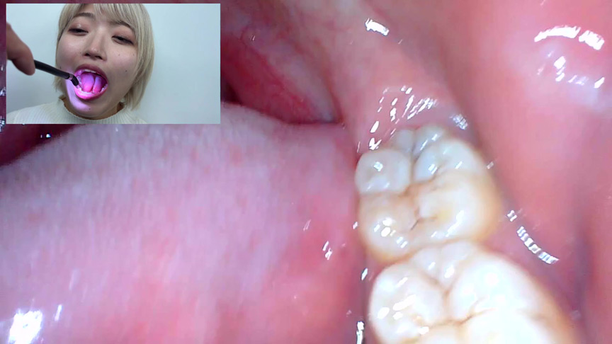 「【口腔観察】歯・舌・喉をじっくり接写！素人4名の口内フェチ動画55分セット」のサンプル画像10枚目