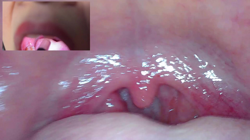 「【口腔観察】歯・舌・喉をじっくり接写！素人4名の口内フェチ動画55分セット」のサンプル画像6枚目