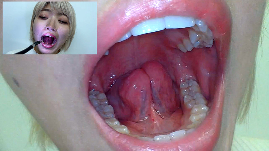 「【素人美容部員】はるのちゃんの口内観察プレイ動画｜歯・舌・喉をじっくり接写【フェチ映像】」のサンプル画像5枚目