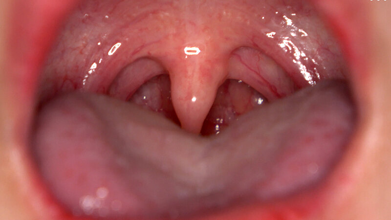 「【相楽さゆな】美少女M女の口内観察＆巨大女フェチプレイ｜歯・口腔フェチ動画」のサンプル画像7枚目