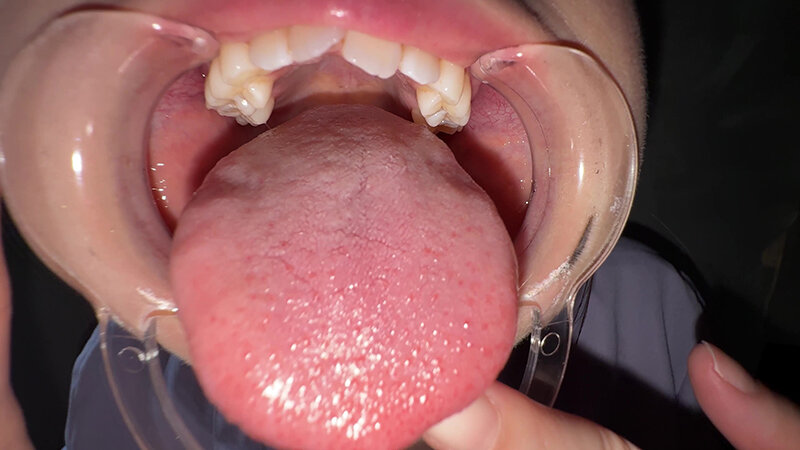 「【谷田かりな】素人お姉さんをナンパ！開口器で口内観察デカ舌チェック【個人撮影】」のサンプル画像20枚目