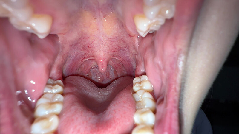 「【谷田かりな】素人お姉さんをナンパ！開口器で口内観察デカ舌チェック【個人撮影】」のサンプル画像3枚目