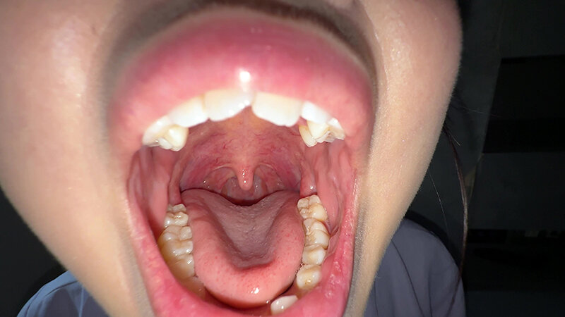 「【谷田かりな】素人お姉さんをナンパ！開口器で口内観察デカ舌チェック【個人撮影】」のサンプル画像4枚目