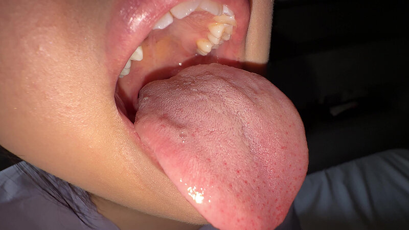 「【谷田かりな】素人お姉さんをナンパ！開口器で口内観察デカ舌チェック【個人撮影】」のサンプル画像8枚目