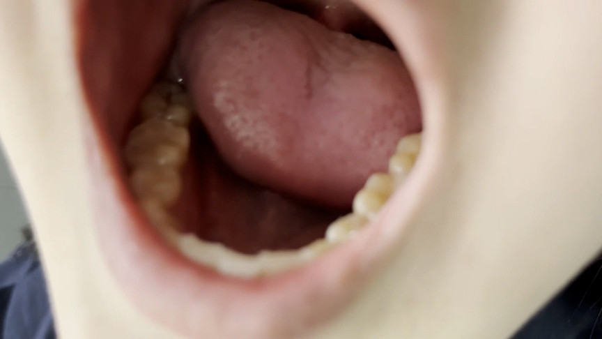 「【口腔観察】歯・舌・喉をじっくり見せる美女4名の口内フェチ動画【お得セット】」のサンプル画像2枚目