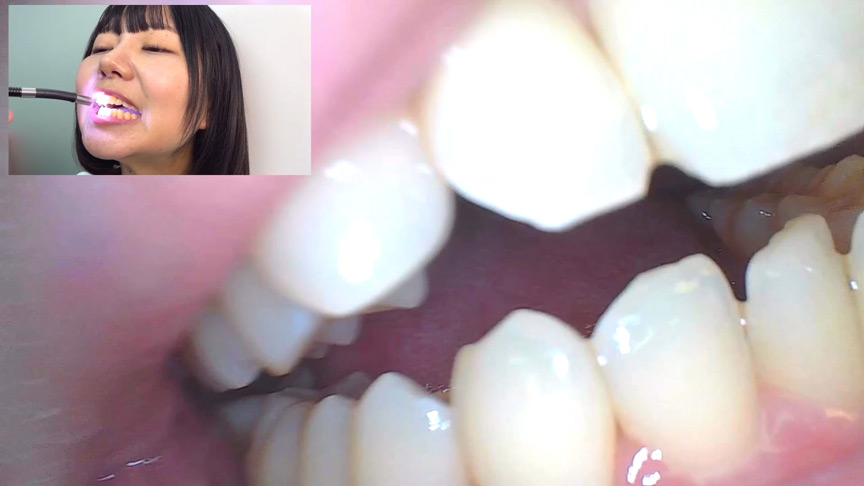 「【素人AD】みゆりちゃんの口内観察プレイ｜街角ナンパ企画で歯・舌・喉をじっくり撮影【フェチ動画】」のサンプル画像15枚目