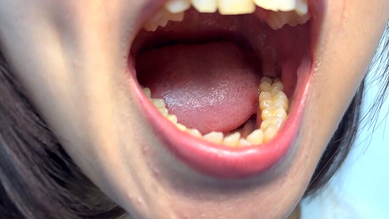 「【素人ナンパ】街角お姉さんみゆりちゃんの口内観察!テレビ局AD美女が恥じらい体験」のサンプル画像5枚目