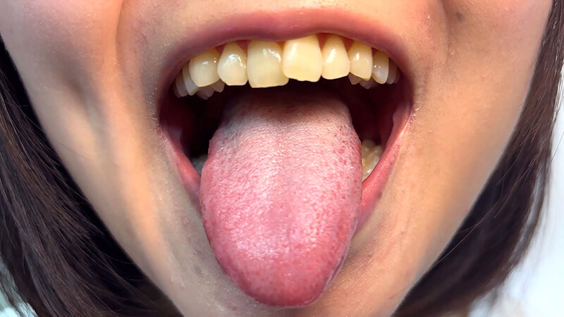 「【素人ナンパ】街角お姉さんみゆりちゃんの口内観察!テレビ局AD美女が恥じらい体験」のサンプル画像7枚目